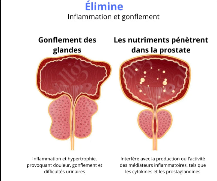 Inhalateur de Soin Corporel pour Prostate