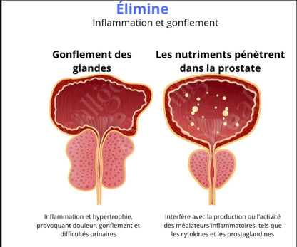Inhalateur de Soin Corporel pour Prostate